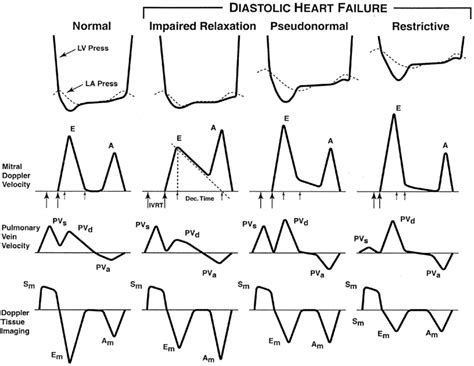 lv funktion|Lv function echo cardiology.